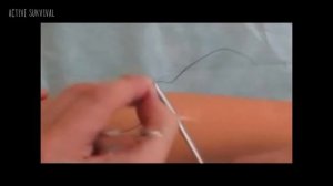 💉 Медицина и хирургия - Техника наложения непрерывного матрацного шва