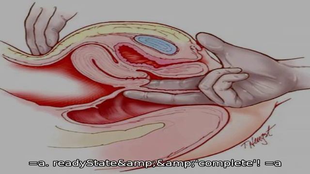 Можно Ли Секс После Инсеминации Можно Ли Секс После Инсеминации