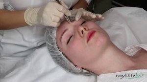 Алмазный пилинг\аппарат Pristine