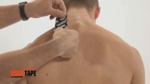 Кинезиотейпирование шейного отдела позвоночника от RockTape