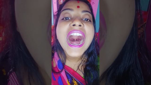 inside open mouth👄zoomcamera challenge videoteeth zoom camera challenge#requestedvideo#bengalivlogs смотреть онлайн
