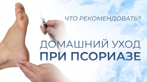 Домашний уход при псориазе. Что рекомендовать?