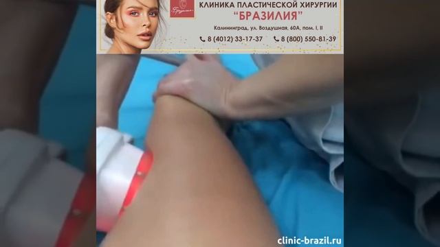 Антицеллюлитный массаж в Калининграде смотреть онлайн