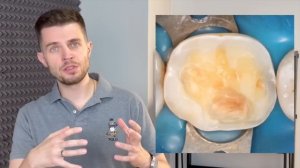 Эндодонтический доступ к облитерированным каналам. Дмитрий Николаев. Уроки эндодонтии. Выпуск 34