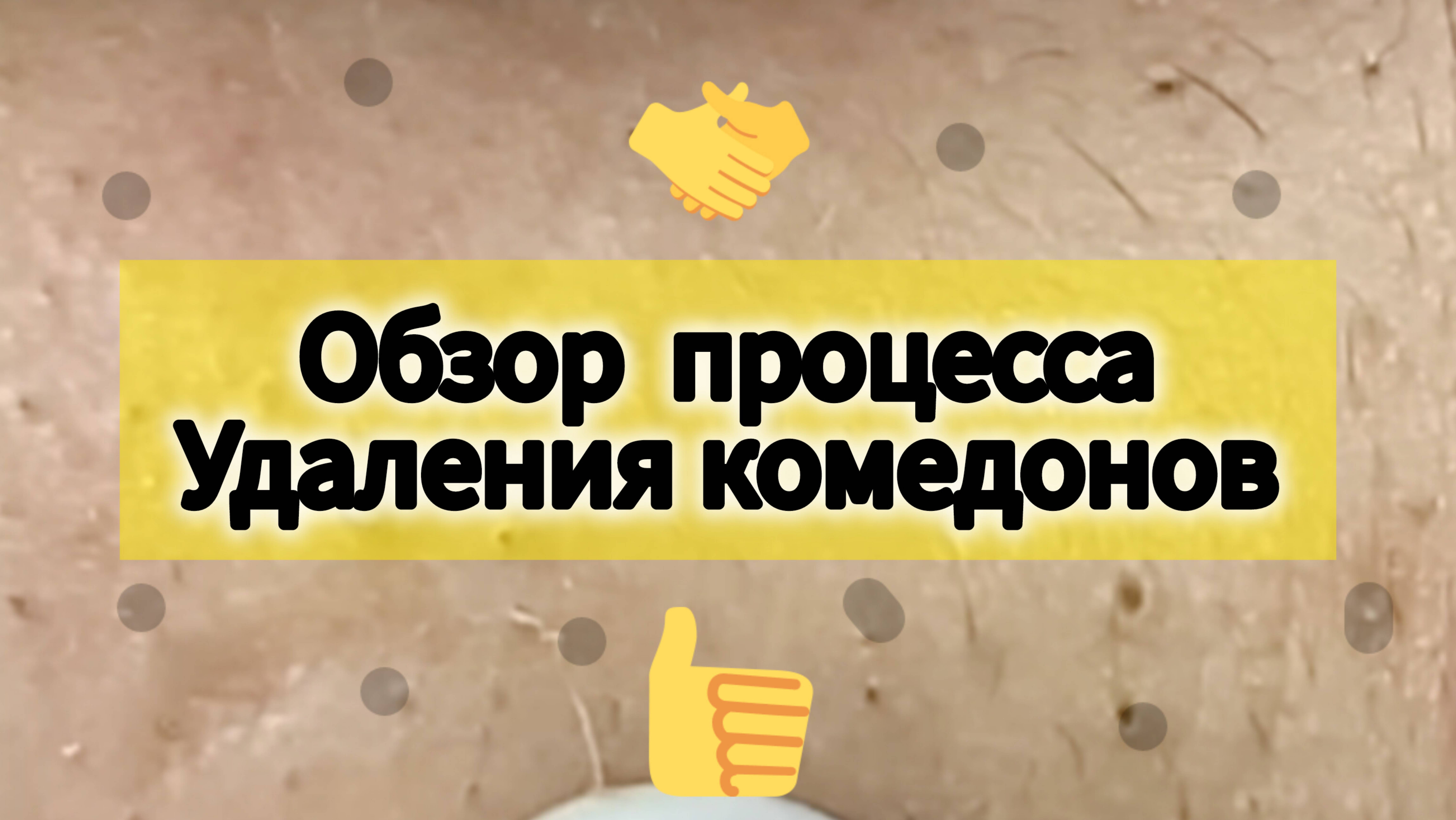 Обзор процесса удаления комедонов. #4
