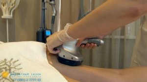 Процедура на аппарате Vela Shape ll