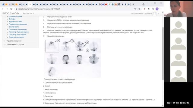 Разбор практического занятия 5. ЛД. ИКМ. Преподаватель Ю.С. Пышкина смотреть онлайн