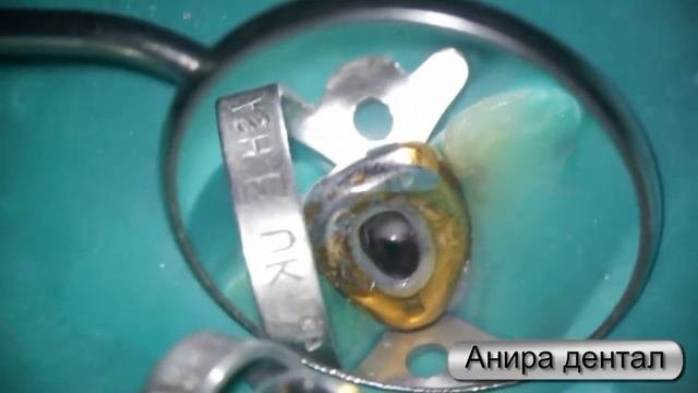 Серебро