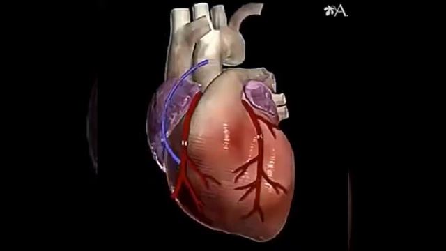 Аортокоронарное шунтирование