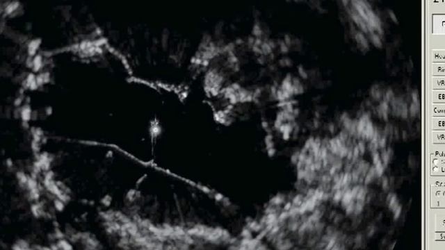 MERLIN Bird Control Radar Systems смотреть онлайн