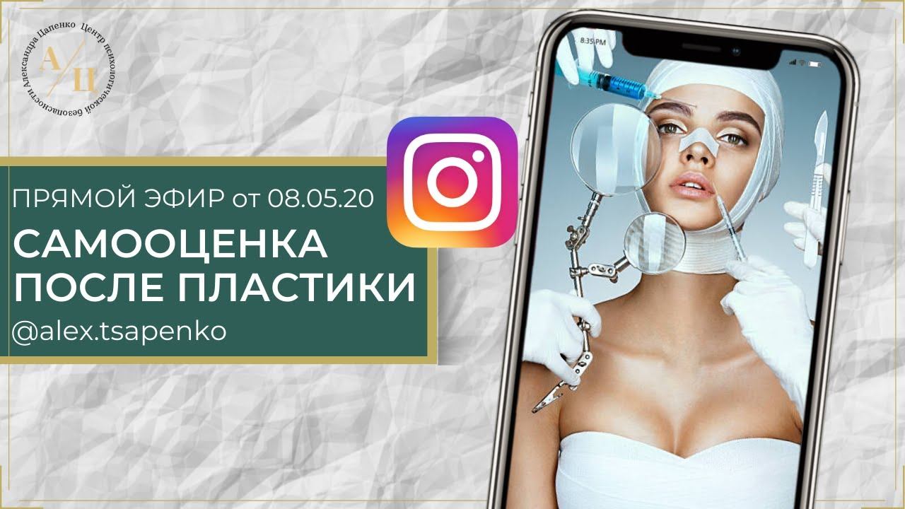 САМООЦЕНКА ПОСЛЕ ПЛАСТИКИ. Эфир от 8.05.20.