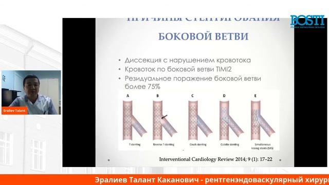 Эралиев Талант Каканович - Бифуркационные поражения коронарных артерий