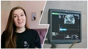 ДНЕВНИК БЕРЕМЕННОСТИ /14-16 НЕДЕЛИ/ПЛАТНОЕ УЗИ/УЗНАЛИ ПОЛ?