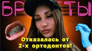 МОЯ ИСТОРИЯ БРЕКЕТОВ | RYLLSKAYA 
Часть 3