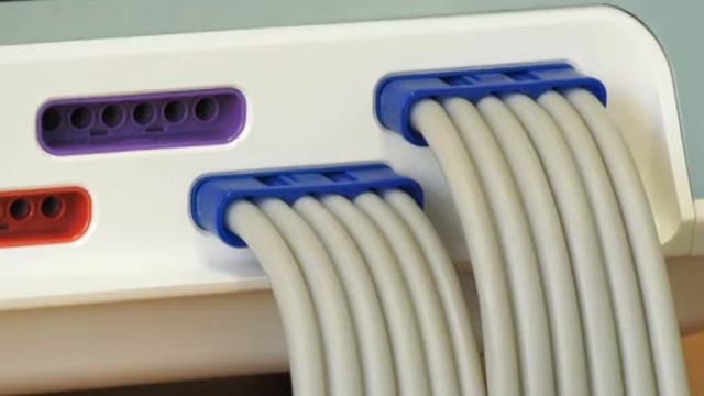 ЛІМФОДРЕНАЖ смотреть онлайн