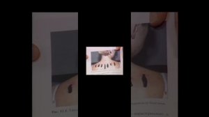 Ольга Гуреева врач ГИРУДОТЕРАПЕВТ Россия. Очищение кровь лимфа