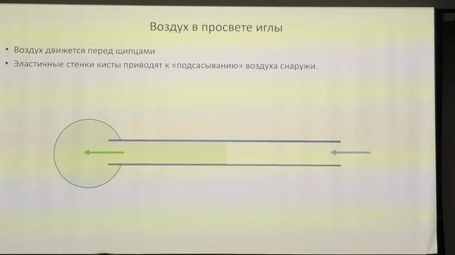 2024 03 28 ЭУС03 Солоницын ЕГ Трансигольная биопсия кист поджелудочной железы смотреть онлайн