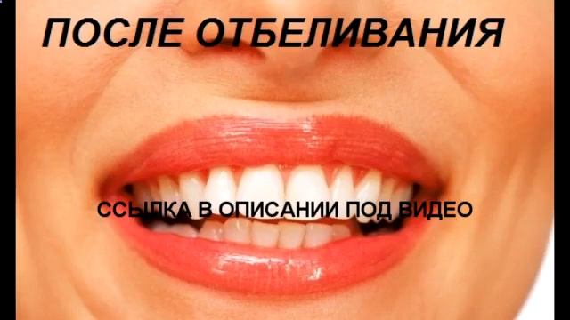 3 d отбеливание зубов смотреть онлайн