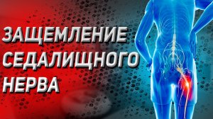 Как снять напряжение в крестцово-подвздошном суставе и убрать защемление седалищного нерва