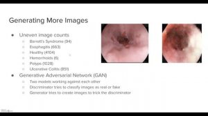 GastroScan Video Presentation