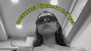 ПОСТАВИЛА БРЕКЕТЫ *второй раз* ♀️| как у меня разъехались зубы