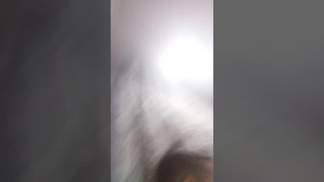 Зайка у мер но хорошие  новости пушистый снежок у не го просто был перелом