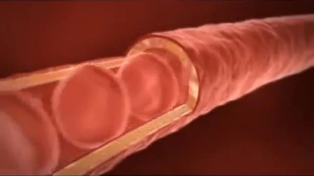 Целебные свойства Алое вера.mp4 - YouTube.flv смотреть онлайн