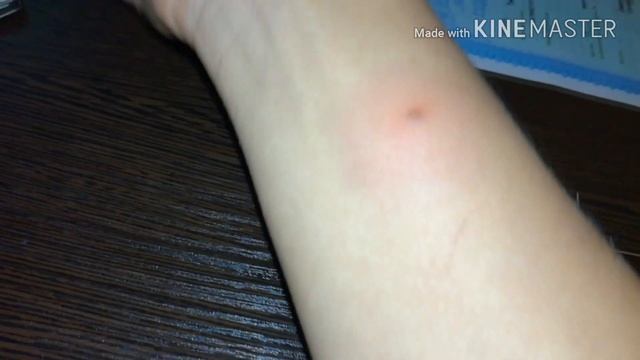 ВЛОГ ✔️ ВОПРЕКИ БОЛИ/ РЕАКЦИЯ на УКУС КОМАРА/ Куртка В ПОДАРОК//// Семья Стулень / Family Stulen` смотреть онлайн