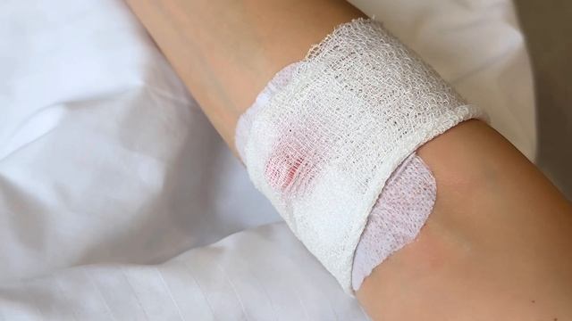 VLOG | Я СДЕЛАЛА МАММОПЛАСТИКУ! ГОЛЛИВУДСКАЯ ГРУДЬ 🍒 смотреть онлайн