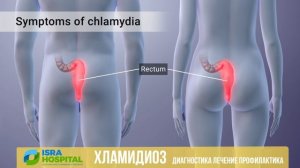 🛑 Хламидиоз - проявления, лечение и профилактика