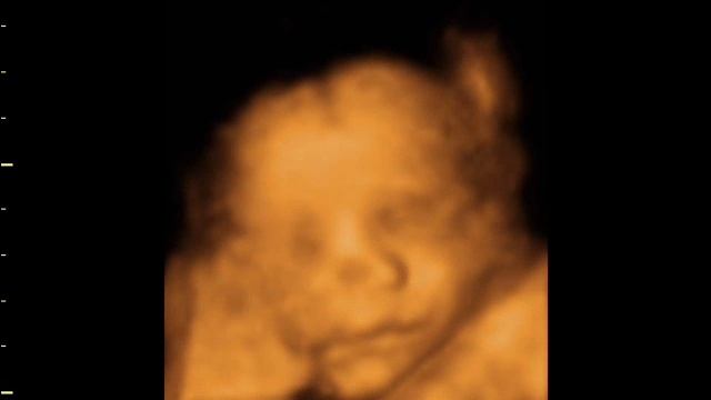 4d baby scan of erika and paul смотреть онлайн