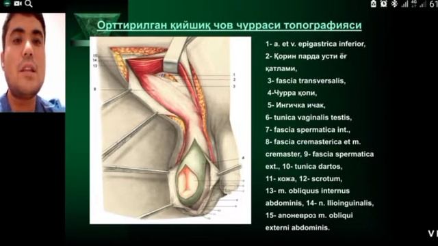 Қорин олд девори чурралари (грыжа) смотреть онлайн