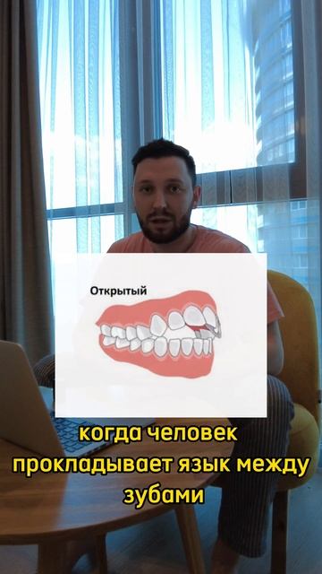НЕПРАВИЛЬНЫЙ ПРИКУС shorts short shortvideo рекомендации рек улыбка зубы стоматология