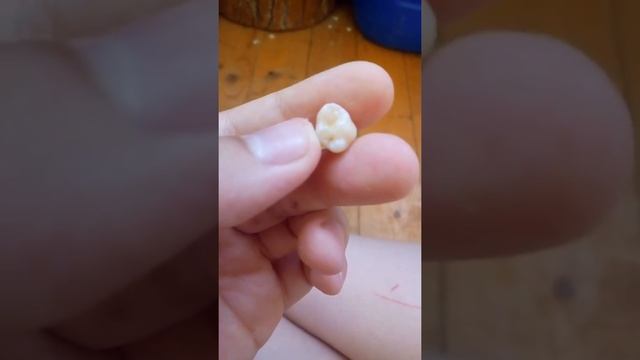 ура я вырвал зуб