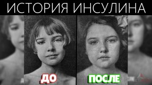 Инсулин: История Чуда, Спасшего Миллионы Жизней | Как Диабет Перестал Быть Смертельным Приговором