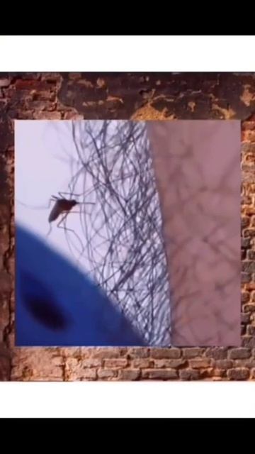 Вот для чего нужны волосы на ногах... #shorts смотреть онлайн