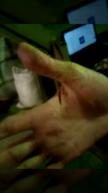 кожа слезла2видео