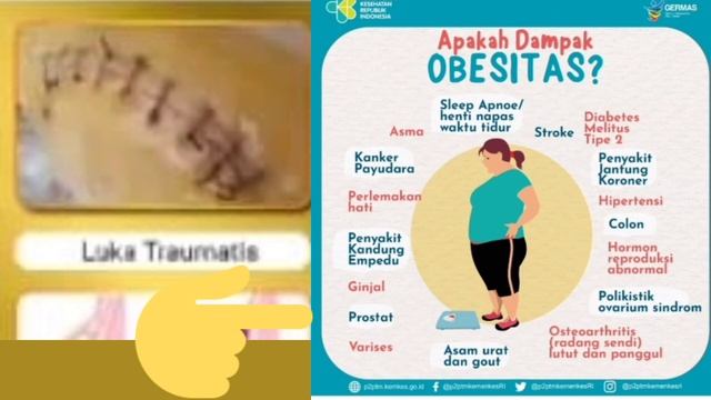 Manfaat Photon Device Pro (Da'i Haekal Muhammad-Trainer Fohoway) смотреть онлайн