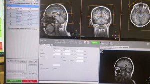 Обучение на МРТ головного мозга на Philips 1.5 тесла