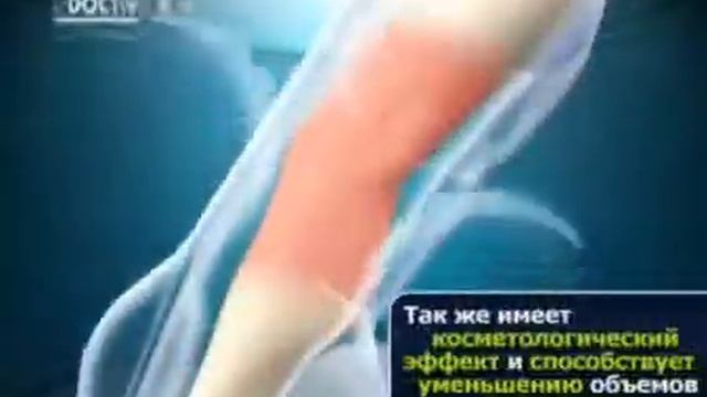 Аппараты прессотерапии и лимфодренажа Doctor Life смотреть онлайн