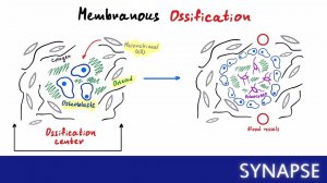 USMLE Step 1 - Типы окостенения. Ахондроплазия.