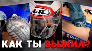 Лишился половины лица после ДТП На мотоцикле
