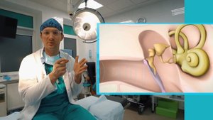 Стапедопластика. Улучшение слуха при ОТОСКЛЕРОЗЕ. Коротко и ясно - суть операции на ухе.