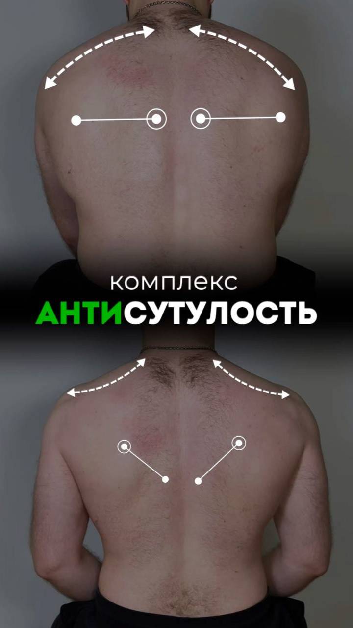 «Комплекс антисутулость». Смотрите в этом видео.