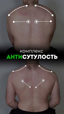«Комплекс антисутулость». Смотрите в этом видео.