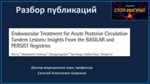 Стволовой инсульт: эндоваскулярная операция