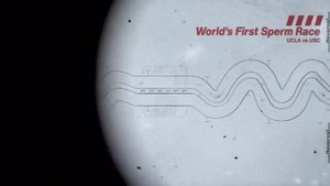 Первые в истории гонки сперматозоидов!