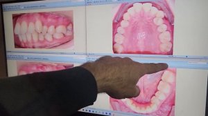 Два идентичных случая. Два разных подхода к лечению