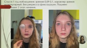 Хороших Е.П. "Первые результаты лечения амблиопии рефракционного генеза у взрослых и детей"