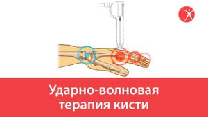 Ударно-волновая терапия кисти